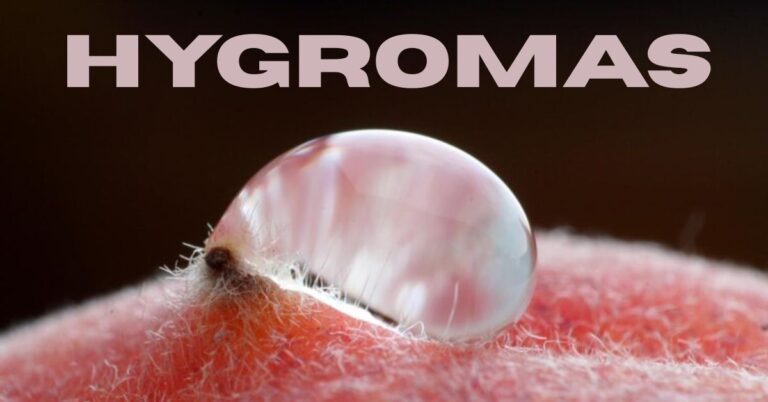 hygromas